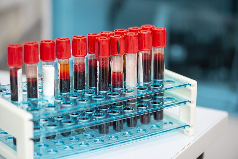 Chẩn đoán bệnh tật thông qua phân tích máu bằng AI Chẩn đoán bệnh tật thông qua phân tích máu bằng AI